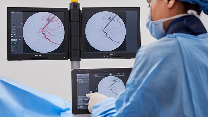 Automatic Vascular Outline（自動血管壁描出機能）