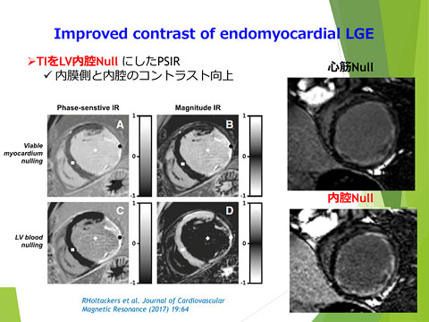Bronze Award 講演資料 1