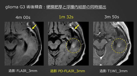 Silver Award 講演資料 2