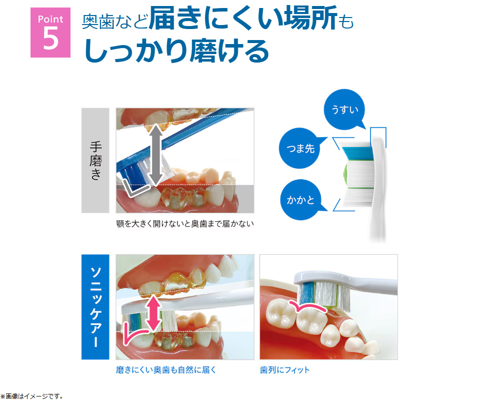ソニックケアーが選ばれる理由5