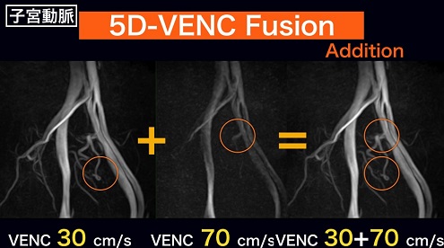 Gyro Cup 2020 Silver Award 発表スライド 2