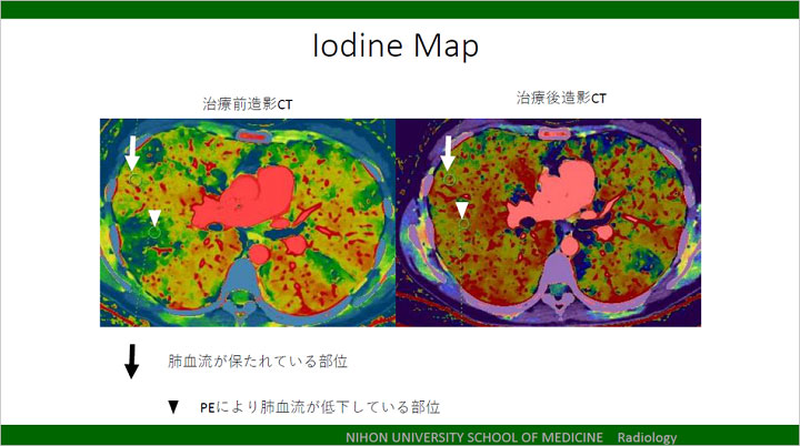 岡田真広先生 講演資料