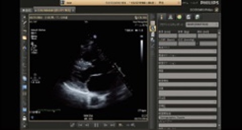 医療機器のスクリーンショット