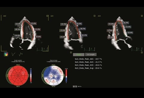 医療機器のスクリーンショット