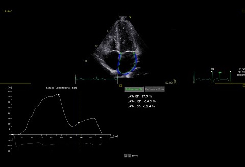 医療機器のスクリーンショット