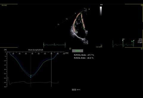 医療機器のスクリーンショット
