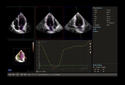 医療機器のスクリーンショット