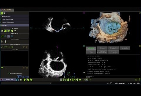 コンピューターのスクリーンショット