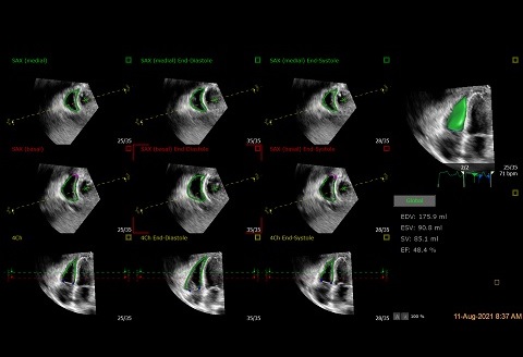 超音波画像のクローズアップ