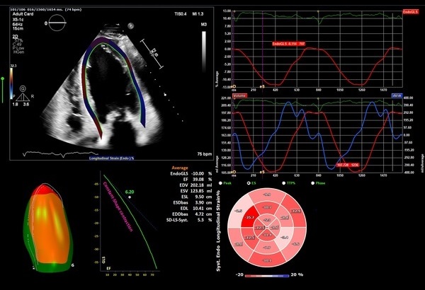 カルテのクローズアップ