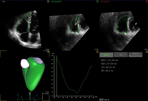 医療機器のスクリーンショット
