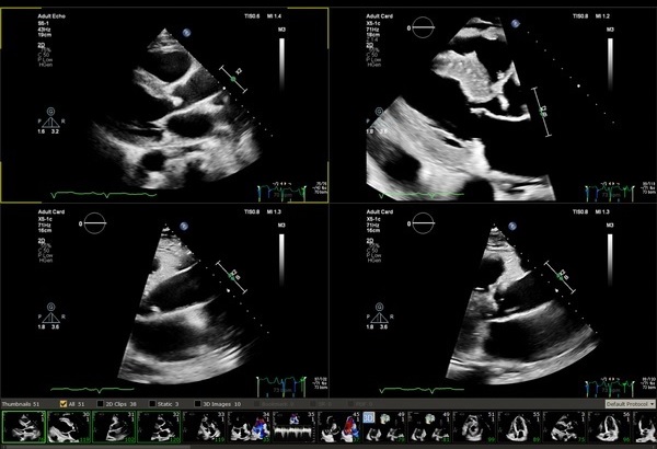 超音波のスクリーンショット