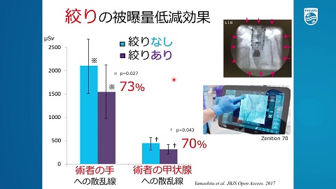整形外科診療に伴う職業被曝の実態とその対策（後編）