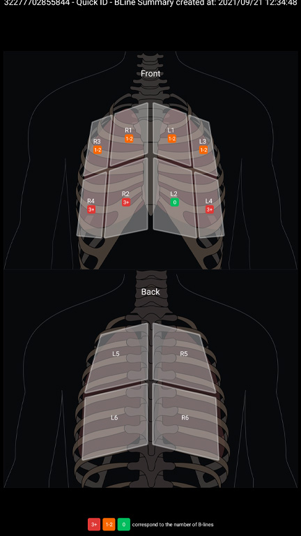 B-Lineサマリ(異常)