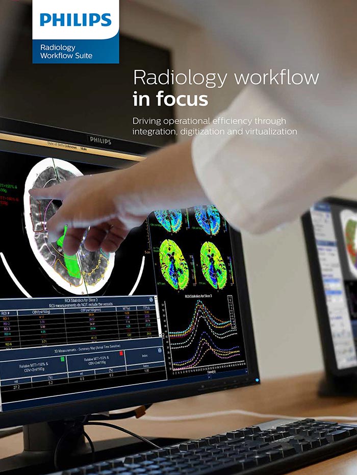 Philips Radiology Workflow Suiteパンフレットの表紙 (download .pdf)