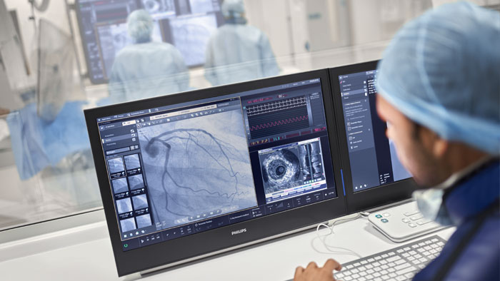 Percutaneous coronary intervention