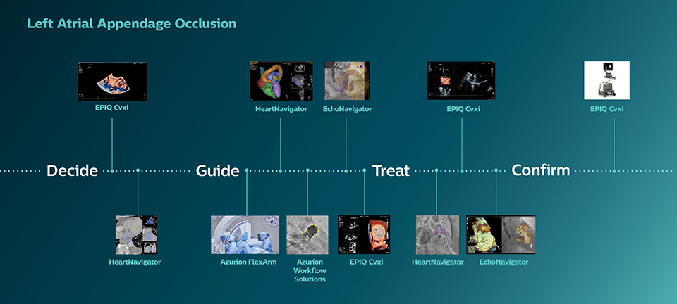 左心耳閉鎖術 image