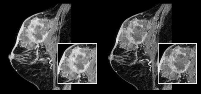 スキャン解像度の向上