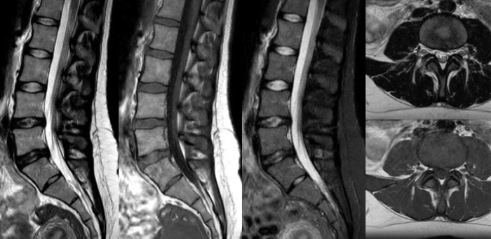 8分のサムネイル image