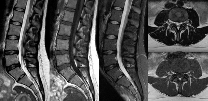 16分のサムネイル image