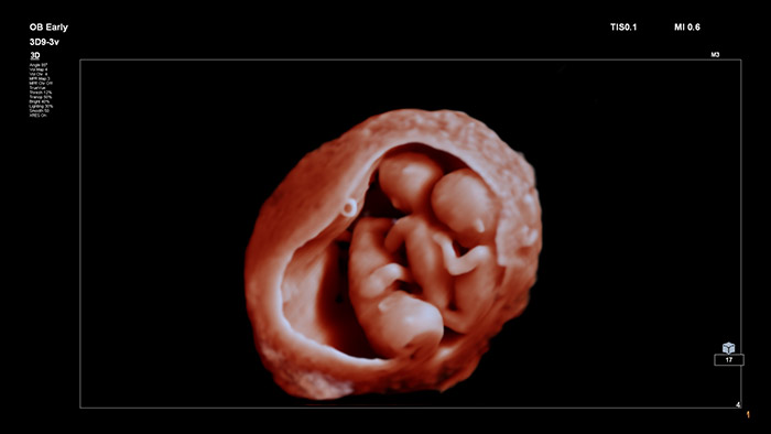 TrueVue 生き生きとしたイメージング