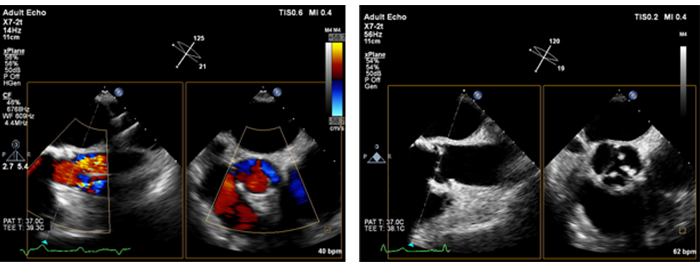 xPlaneイメージング image