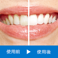 使用前と使用後の白さの違いイメージ